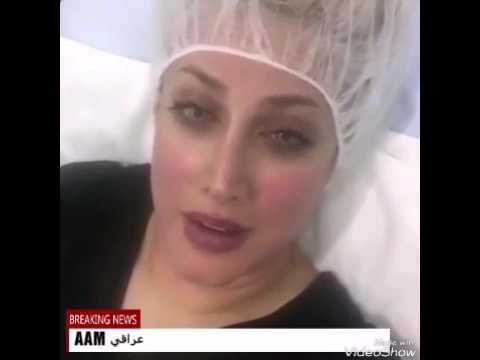 فضيحة #1 الفنانه ميس كمر  وجه كله عمليات تجميل 😂