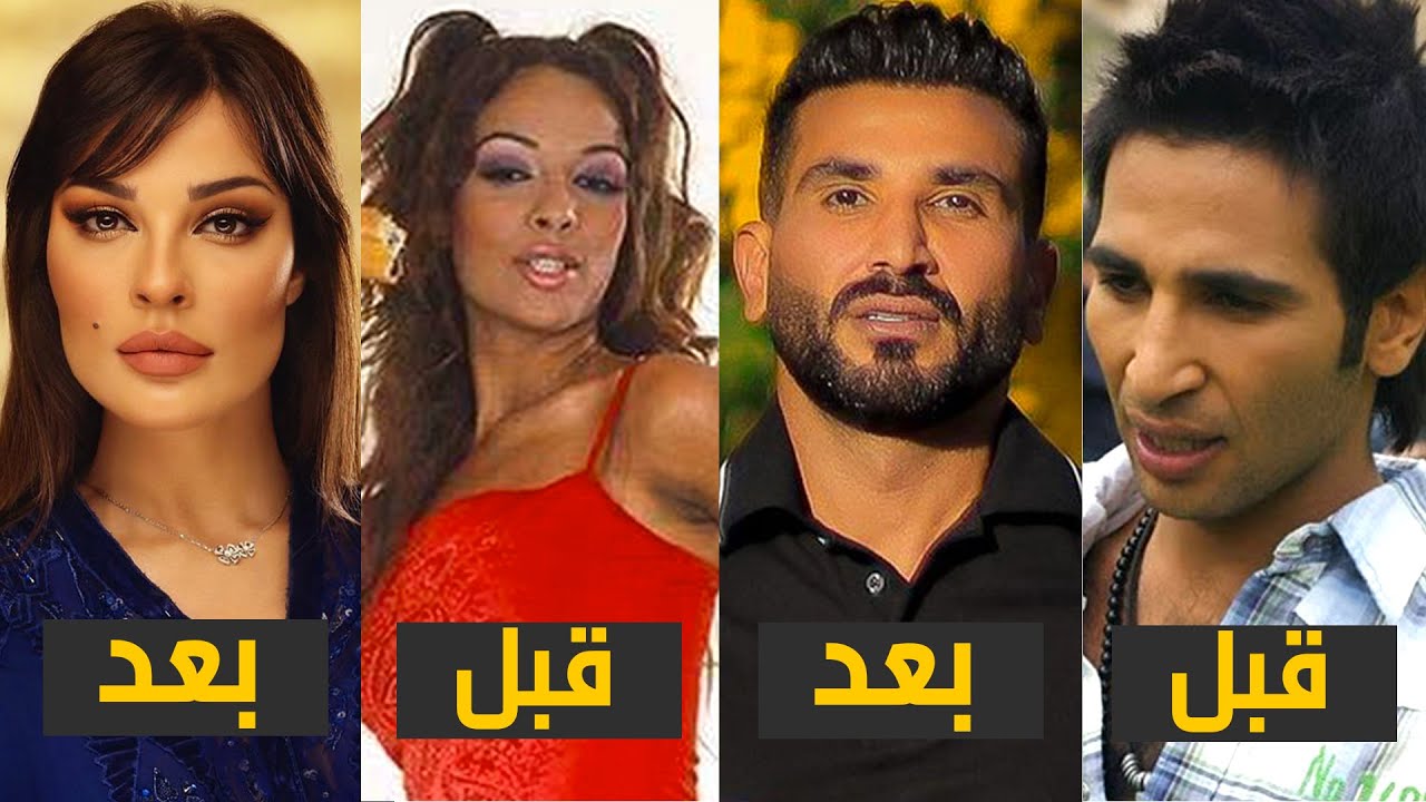 8 فنانين تحولو قبل وبعد عمليات التجميل