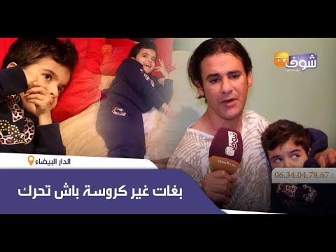 طفلة كتعاني من إعاقة جسدية وذهنية وبغات غير كروسة باش تحرك