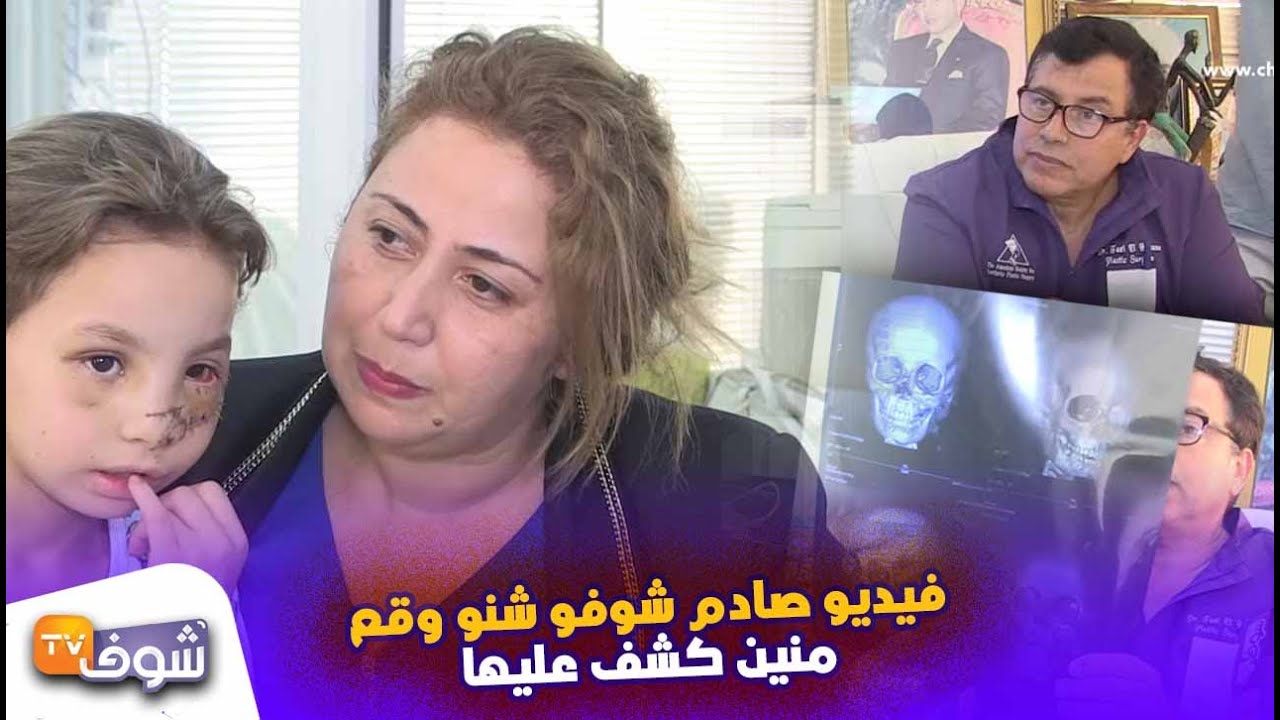 صادم ..الطفلة الجميلة اللي طاح عليها سقف و تحلات ليها عينيها تكلف التازي بعلاجها