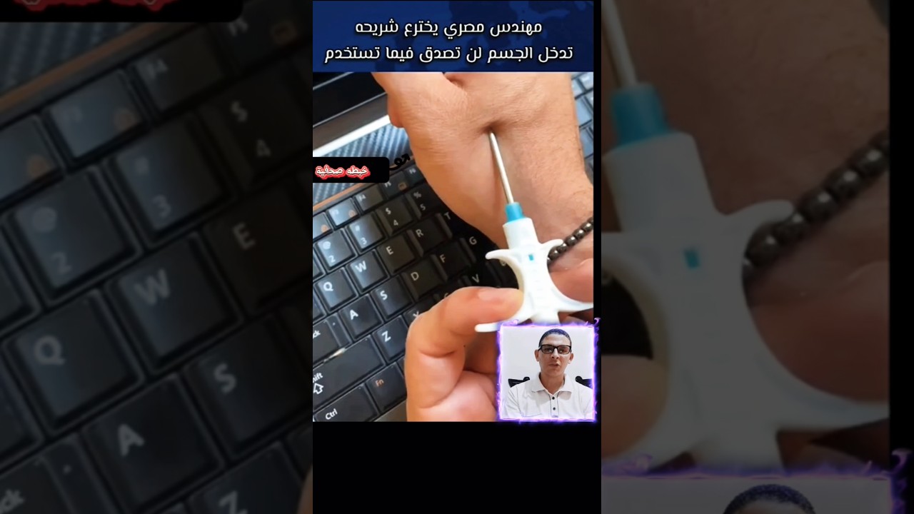 اول مصرى يقوم بزراعه شريحه رقمية اليكترونيه فى يده ؟