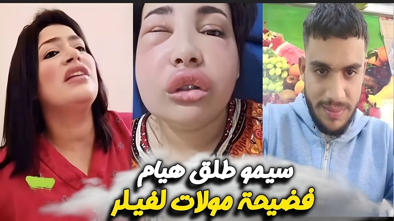 نايضة سـيمو زوج هيام مشا دفع الطلاق 😳 فضيحة مولات لفيلر والقضية كبيرة وفيها رشوة متخيلوش شنو وقع